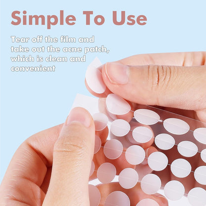 Pimple Patches for Face 304PCS, Hydrocolloid Star Zit Acne Patches
