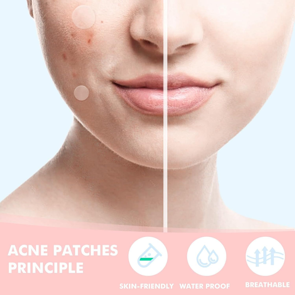 Pimple Patches for Face 304PCS, Hydrocolloid Star Zit Acne Patches